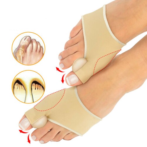 Non-Surgical Hallux Valgus Correction